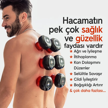 Lumora™ - Şarjlı Akıllı Hacamat